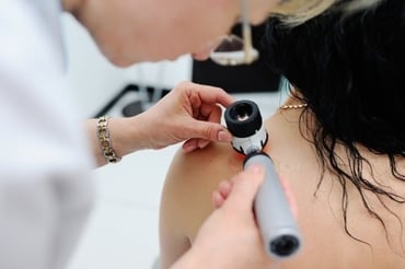 How Does Your Family’s History of Melanoma Affect You?