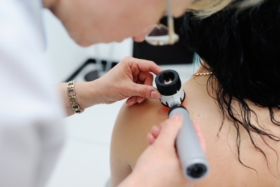 How Does Your Family’s History of Melanoma Affect You?