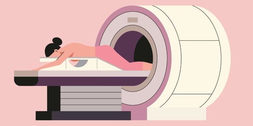 When Do You Need a Breast MRI and What is the BI-RADS Score?