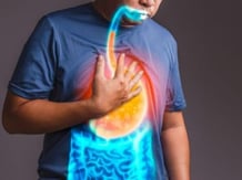 can-acid-reflux-cause-gi-cancer
