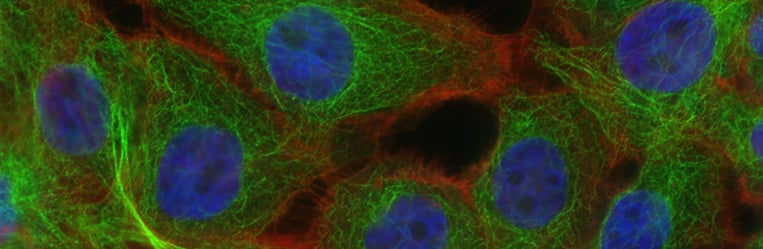 compass_onc_types_of_cancer_bnr