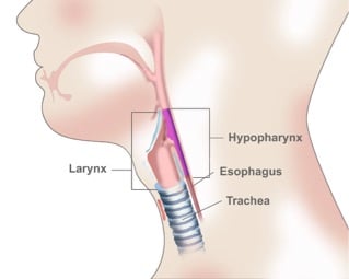 hypopharyngeal_cancer