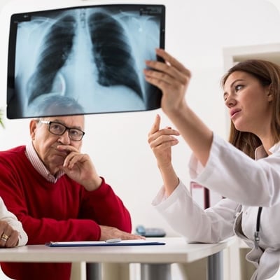commonly asked questions about lung cancer
