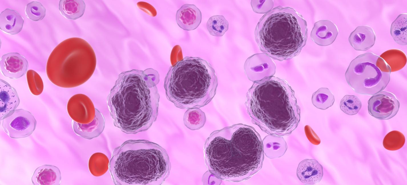 subtypes-of-non-hodgkin-lymphoma-portland-hematologists